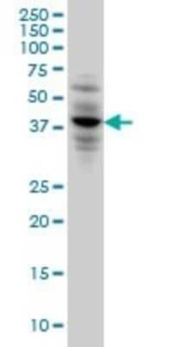 CACNG3 Antibody (3E4), Novus Biologicals 0.1 mg | Buy Online | Novus Biologicals | Fisher Scientific