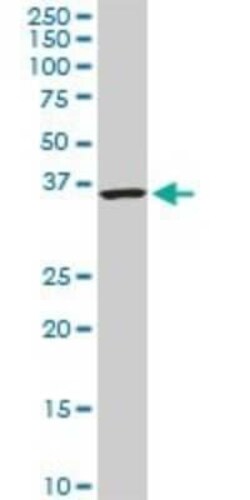 CACNG3 Antibody (3E4), Novus Biologicals 0.1 mg | Buy Online | Novus Biologicals | Fisher Scientific