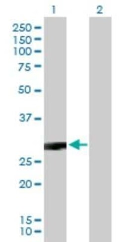 CACNG3 Antibody, Novus Biologicals 0.05 mg | Buy Online | Novus Biologicals | Fisher Scientific