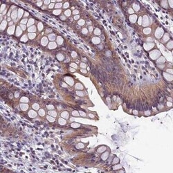 CACNG8 Antibody, Novus Biologicals:Antibodies:Primary Antibodies