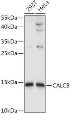 CALCB Antibody - BSA Free, Novus Biologicals:Antibodies:Primary Antibodies