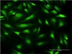 CALML3 Antibody (2A11), Novus Biologicals 0.1 mg | Buy Online | Novus Biologicals | Fisher Scientific