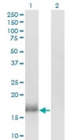 CALML3 Antibody (2A11), Novus Biologicals 0.1 mg | Buy Online | Novus Biologicals | Fisher Scientific