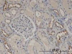 CALML5 Antibody (2F10), Novus Biologicals 0.1 mg | Buy Online | Novus Biologicals | Fisher Scientific