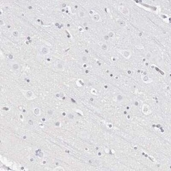 CAMP/Cathelicidin Antibody, Novus Biologicals:Antibodies:Primary Antibodies