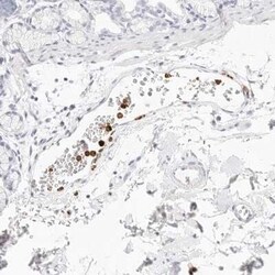 CAMP/Cathelicidin Antibody, Novus Biologicals:Antibodies:Primary Antibodies