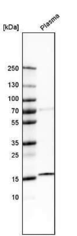 CAMP/Cathelicidin Antibody, Novus Biologicals:Antibodies:Primary Antibodies
