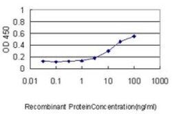 CAP1 Antibody (4A2), Novus Biologicals 0.1 mg | Buy Online | Novus Biologicals | Fisher Scientific
