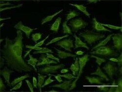 CAP1 Antibody (4A9), Novus Biologicals 0.1 mg | Buy Online | Novus Biologicals | Fisher Scientific