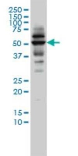 CAP2 Antibody (3G9-1A5), Novus Biologicals 0.1 mg | Buy Online | Novus Biologicals | Fisher Scientific