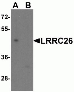 CAPC/ LRRC26 Antibody - BSA Free, Novus Biologicals 0.1 mg; Unconjugated:Antibodies,