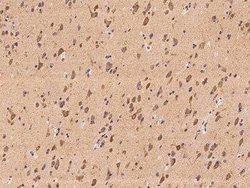 CAPRIN2 Antibody, Novus Biologicals 50 &mu;g | Buy Online | Novus Biologicals | Fisher Scientific