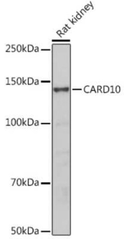CARD10 Antibody - BSA Free, Novus Biologicals 0.1 mL, Unconjugated:Antibodies,
