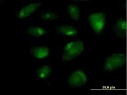 CARD9 Antibody, Novus Biologicals 50 &mu;g | Buy Online | Novus Biologicals | Fisher Scientific