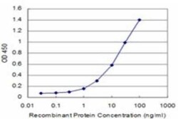 CARF/CDKN2AIP Antibody (1E10), Novus Biologicals 0.1 mg | Buy Online | Novus Biologicals | Fisher Scientific