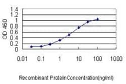 CARF/CDKN2AIP Antibody (1F7), Novus Biologicals 0.1 mg | Buy Online | Novus Biologicals | Fisher Scientific
