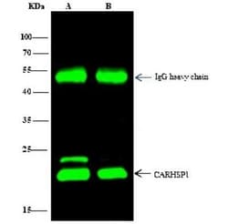 CARHSP1 Antibody, Novus Biologicals:Antibodies:Primary Antibodies