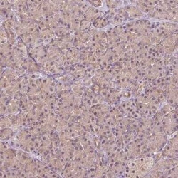 CARKL Antibody, Novus Biologicals 0.1 mL, Unconjugated:Antibodies, Polyclonal