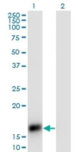 CART/CARTPT Antibody (3E4), Novus Biologicals 0.1 mg | Buy Online | Novus Biologicals | Fisher Scientific
