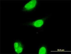 CART1 Antibody (2A10), Novus Biologicals 0.1 mg | Buy Online | Novus Biologicals | Fisher Scientific