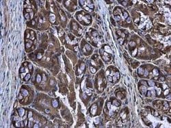 CASK Antibody, Novus Biologicals 100 &mu;g | Buy Online | Novus Biologicals | Fisher Scientific