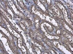 CASK Antibody, Novus Biologicals 100 &mu;g | Buy Online | Novus Biologicals | Fisher Scientific