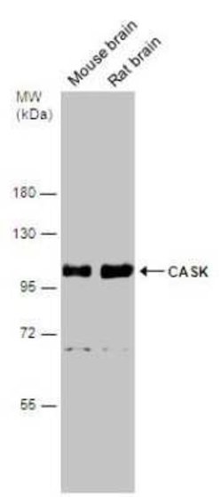 CASK Antibody, Novus Biologicals 100 &mu;g | Buy Online | Novus Biologicals | Fisher Scientific