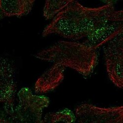 CASKIN2 Antibody, Novus Biologicals 100 &mu;g; Unconjugated:Antibodies,