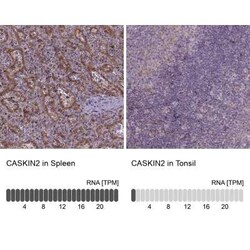 CASKIN2 Antibody, Novus Biologicals 100 &mu;g; Unconjugated:Antibodies,
