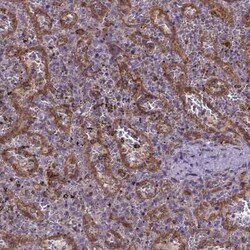 CASKIN2 Antibody, Novus Biologicals 100 &mu;g; Unconjugated:Antibodies,