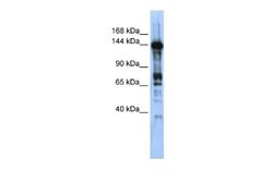 CASZ1 Antibody, Novus Biologicals 100 &mu;L; Unconjugated:Antibodies, Polyclonal