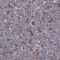 CAT1 Rabbit anti-Human, Polyclonal, Novus Biologicals:Antibodies:Primary