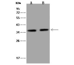 CBF2 Antibody, Novus Biologicals 100 &mu;g, Unconjugated:Antibodies, Polyclonal