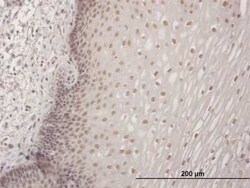 CBFA2T3 Antibody, Novus Biologicals 0.05 mg | Buy Online | Novus Biologicals | Fisher Scientific