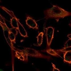 CBFB Mouse anti-Human, Clone: PCRP-CBFB-1E6, Novus Biologicals 20 &mu;g;