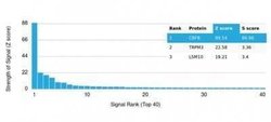 CBFB Mouse anti-Human, Clone: PCRP-CBFB-1E6, Novus Biologicals 20 &mu;g;