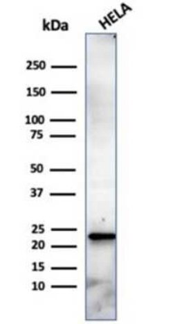 CBFB Mouse anti-Human, Clone: PCRP-CBFB-1E6, Novus Biologicals 20 &mu;g;