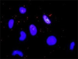 CBP/KAT3A Antibody (2H5), Novus Biologicals 0.1 mg | Buy Online | Novus Biologicals | Fisher Scientific