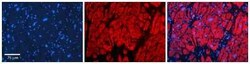 CBR1 Antibody, Novus Biologicals 100 &mu;g; Unconjugated:Antibodies, Polyclonal