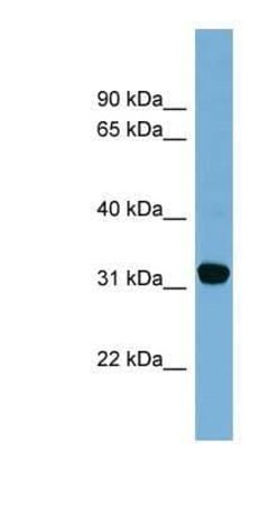 CBR1 Antibody, Novus Biologicals 100 &mu;g; Unconjugated:Antibodies, Polyclonal