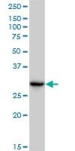 CBR3 Antibody (1G8), Novus Biologicals 0.1 mg | Buy Online | Novus Biologicals | Fisher Scientific