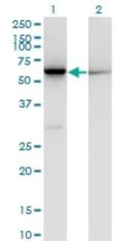 CBS Antibody (3D10), Novus Biologicals 0.1 mg; Unconjugated:Antibodies,