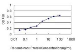 CBS Antibody (3E1), Novus Biologicals 0.1 mg | Buy Online | Novus Biologicals | Fisher Scientific
