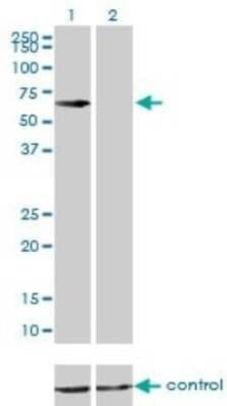 CBS Antibody (3E1), Novus Biologicals 0.1 mg | Buy Online | Novus Biologicals | Fisher Scientific