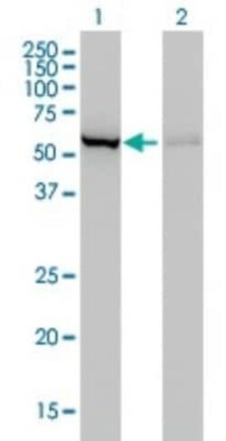 CBS Antibody (3E1), Novus Biologicals 0.1 mg | Buy Online | Novus Biologicals | Fisher Scientific