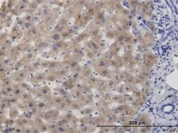 Novus Biologicals CBS Antibody (6A9), Novus Biologicals 0.1 mg | Buy Online | Novus Biologicals&trade; | Fisher Scientific