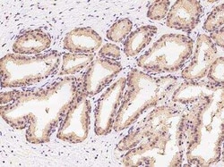 CBWD1 Antibody, Novus Biologicals 50 &mu;g; Unconjugated:Antibodies, Polyclonal