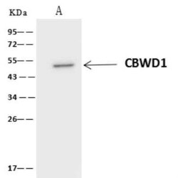 CBWD1 Antibody, Novus Biologicals 50 &mu;g; Unconjugated:Antibodies, Polyclonal
