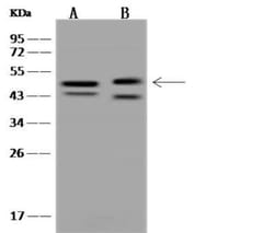 CBWD1 Antibody, Novus Biologicals 50 &mu;g; Unconjugated:Antibodies, Polyclonal