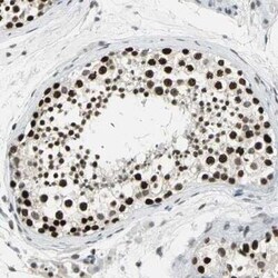 CBX3 Antibody, Novus Biologicals 25 &mu;L | Buy Online | Novus Biologicals | Fisher Scientific